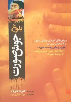 جلد کتاب بلوغ:جوش صورت (راهنمای دختران و پسران)
