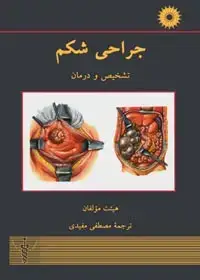 جلد کتاب جراحی شکم (تشخیص و درمان)