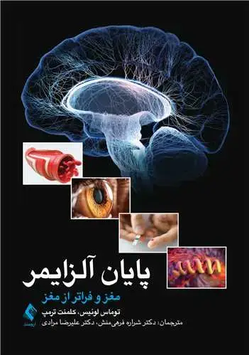 جلد کتاب پایان آلزایمر مغز و فراتر از مغز
