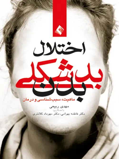 جلد کتاب اختلال بدشکلی بدن ماهیت، علل و درمان