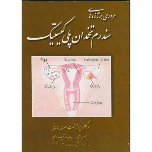 جلد کتاب مروری برتازه های سندرم تخمدان پلی کیستیک