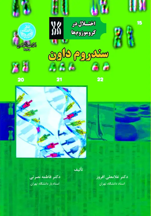 جلد کتاب سندروم داون