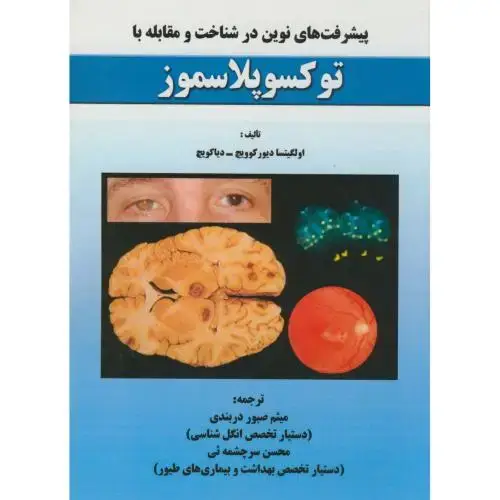 جلد کتاب پیشرفت های نوین در شناخت و مقابله با توکسوپلاسموز،صبوردربندی،پریورتبریز