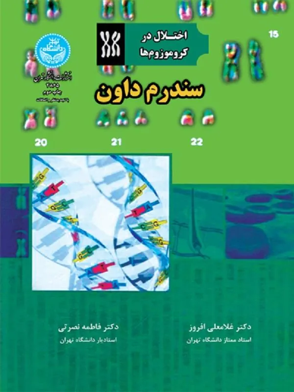 سندروم داون