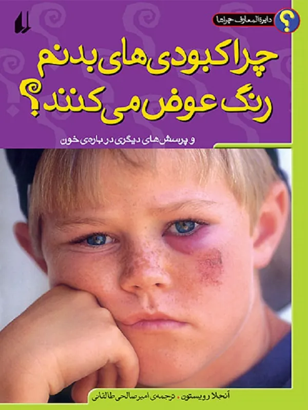 کتاب چرا کبودی های بدنم رنگ عوض می کنند